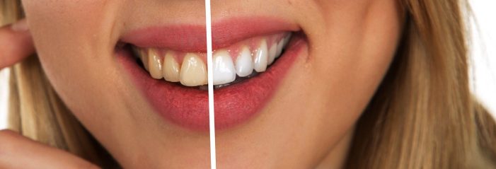 Ein strahlendes Lächeln – die perfekte Zahnpflege hängt von vielen verschiedenen Faktoren ab